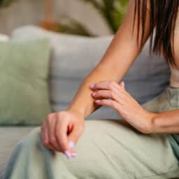 Young woman with an itchy skin rash sitting on her couch.